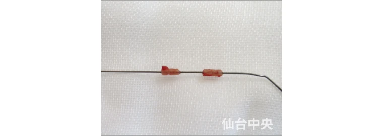 パイプカット症例写真2 切除した精管の確認