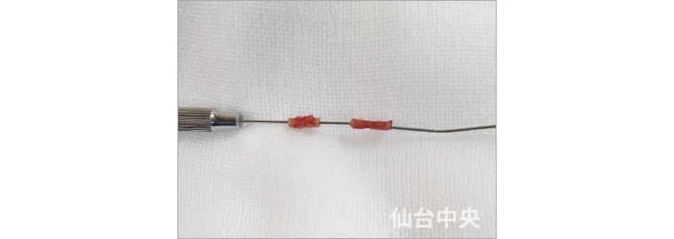 パイプカット症例写真4 切除した精管の確認